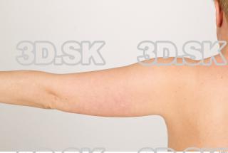 Arm texture of Pat 0002